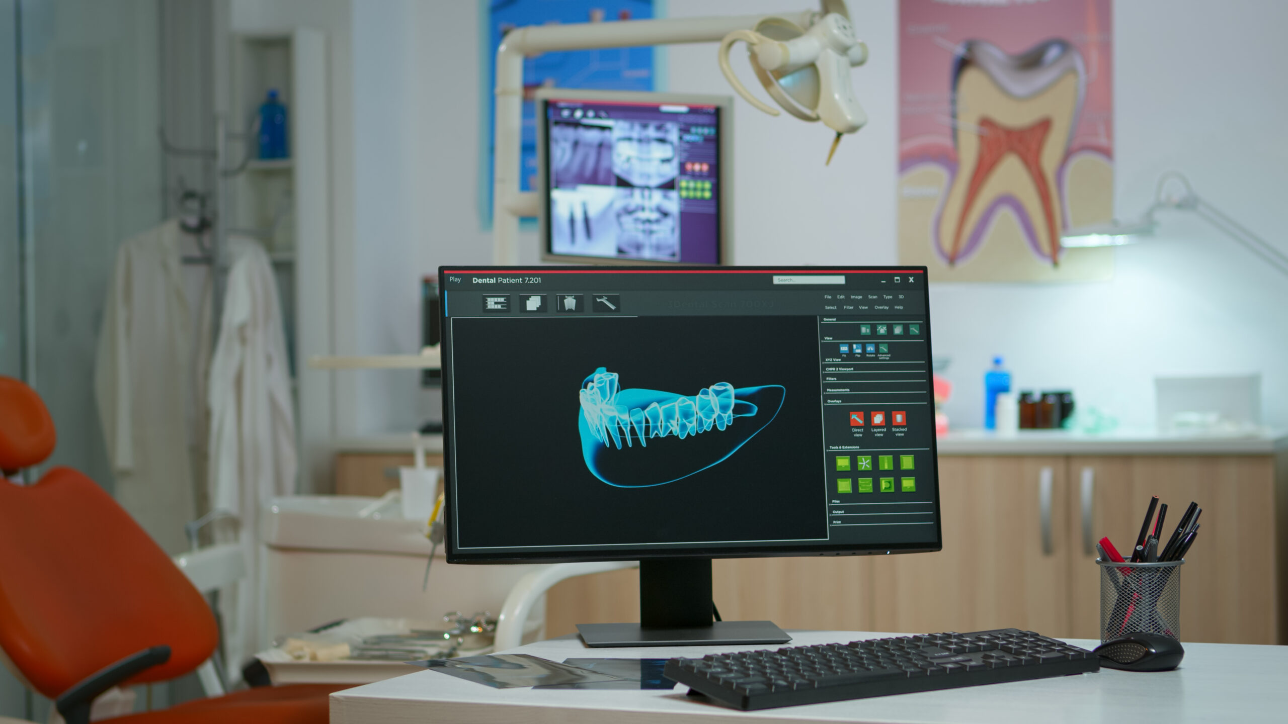 implantologia computer-guidata